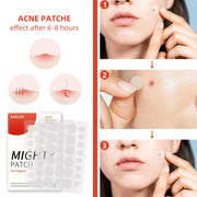 Youbuy invisible acne patch concealer acne patch acne remover without powder stuck acne patch 72 PATCHES